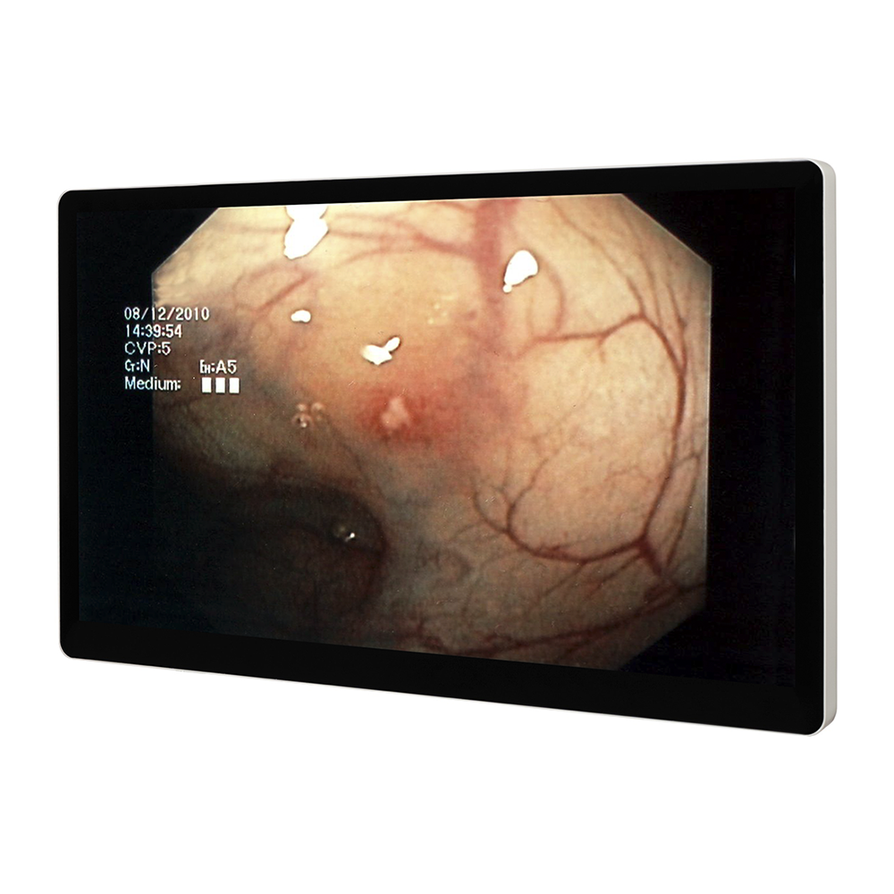 Medical Monitor-01